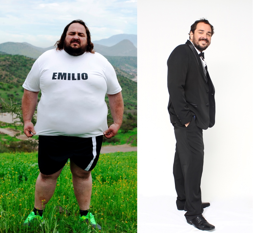 emilio antes y después