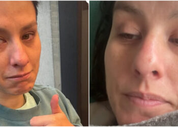 Lady Ganga sufre un inesperado accidente  