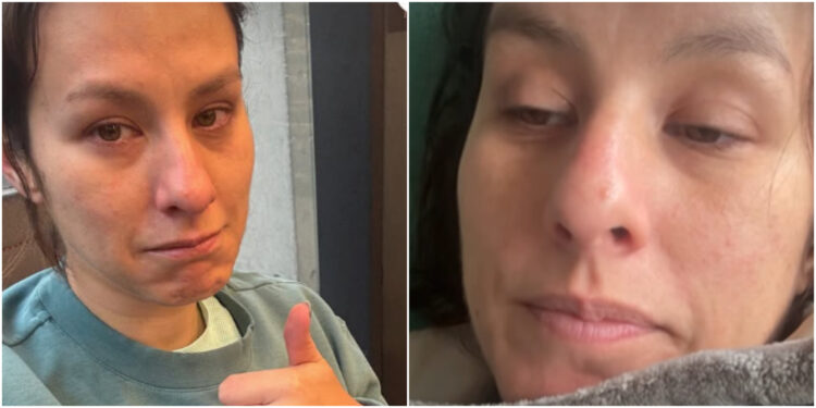Lady Ganga sufre un inesperado accidente