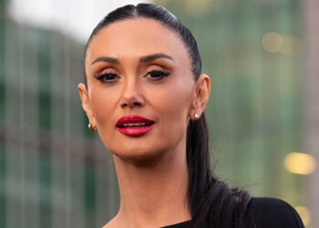 Pamela Díaz impacta con su nuevo retoque estético
