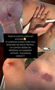 María José Prieto sufrió insólito accidente de tránsito