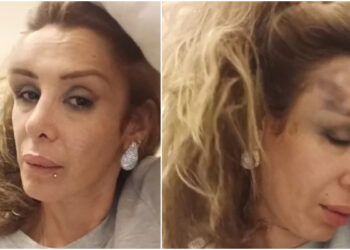 Romina Sáez denuncia que fue violentamente golpeada