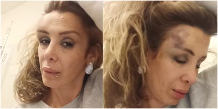 Romina Sáez denuncia que fue violentamente golpeada