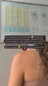 Participante de «Fiebre de Baile» sufre inesperada lesión